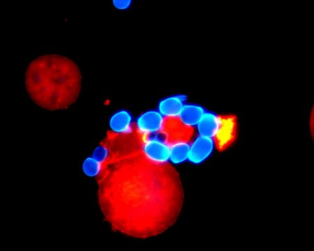 Menschliche Fresszellen – Makrophagen – (rot) und der Hefepilz Candida albicans (blau) Quelle: Andrea Hartmann, Leibniz-HKI